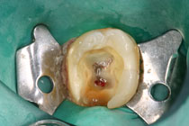 Endodontia